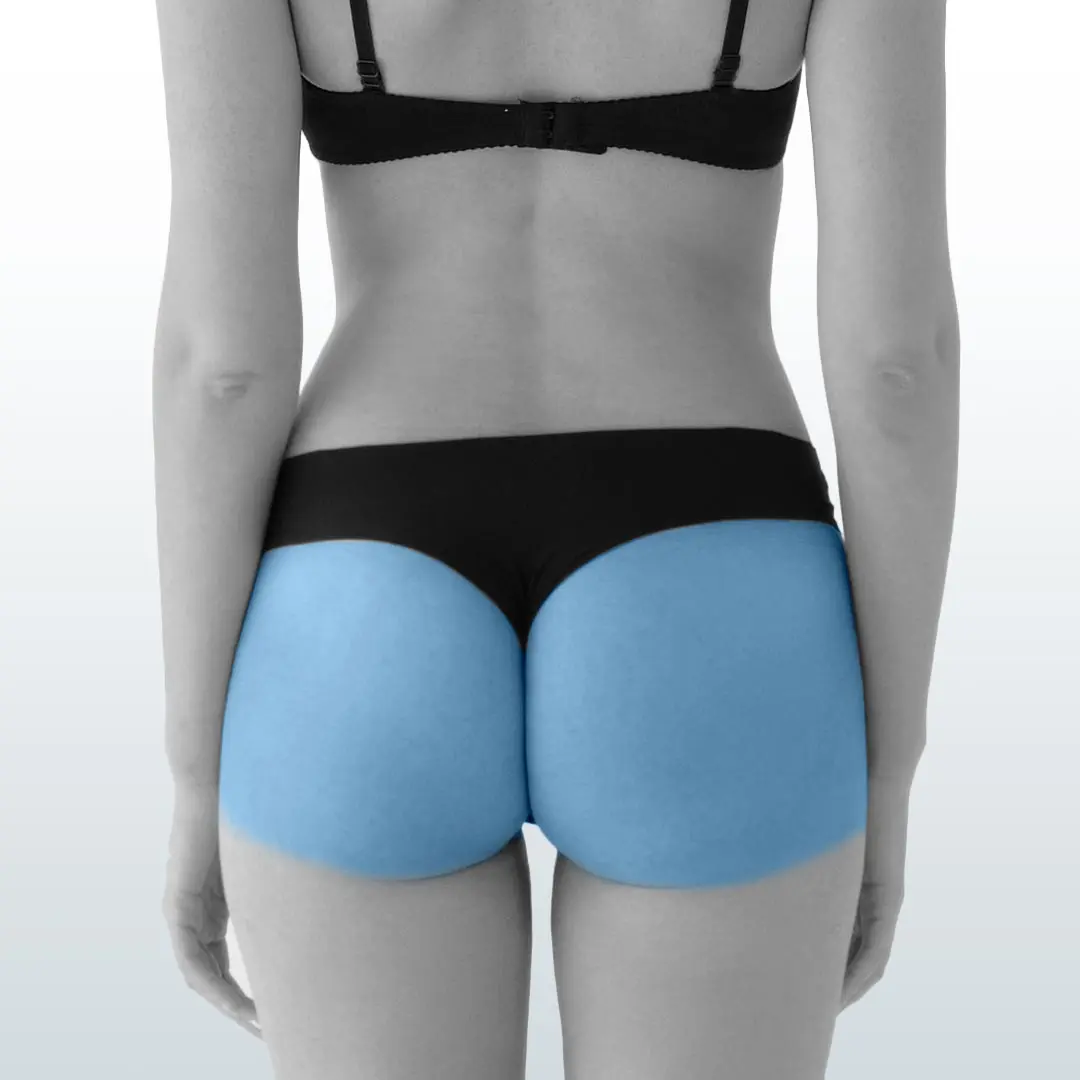 Depilación Glúteos (M) – Santiago – Aura Laser