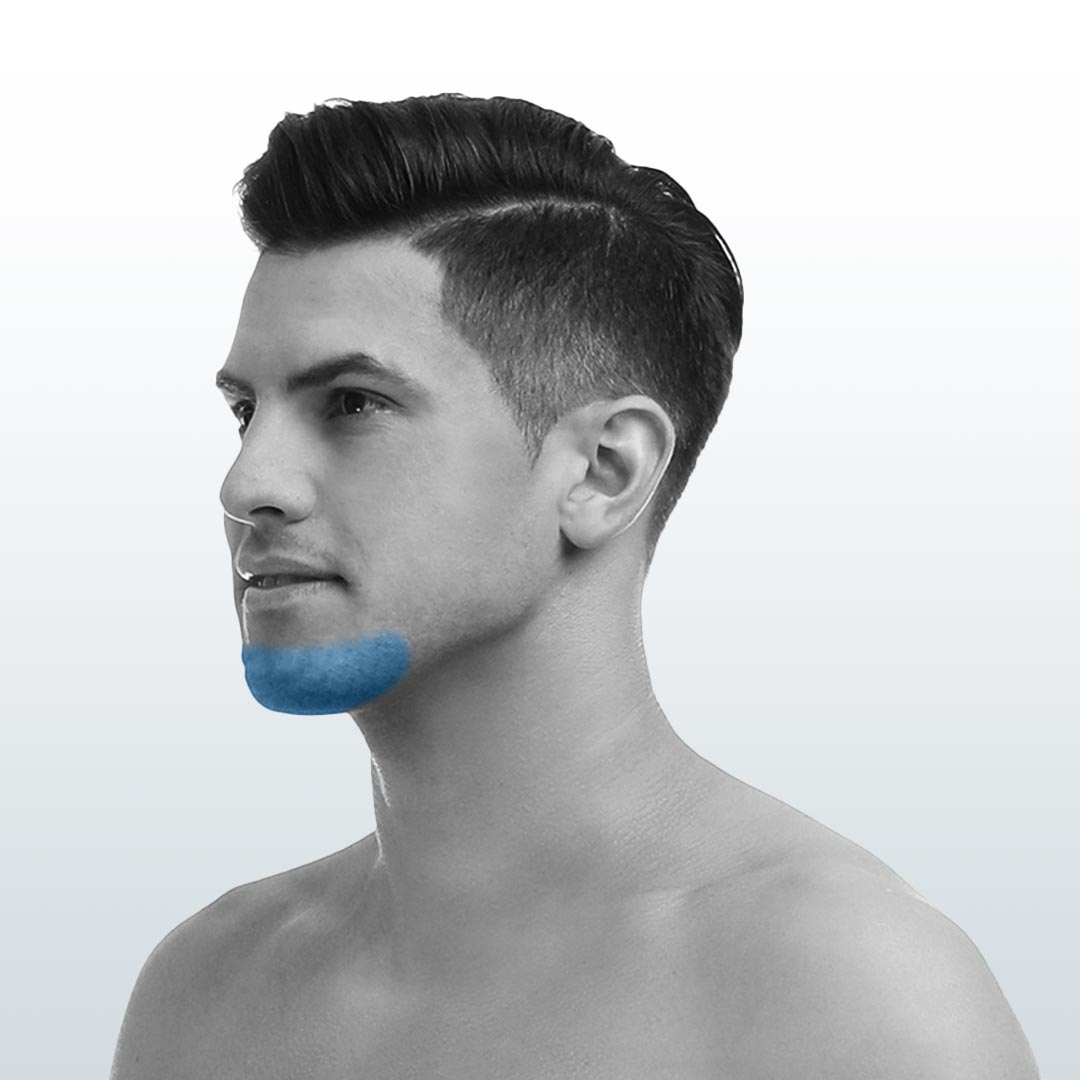 Depilación Mentón (XS) - Santiago