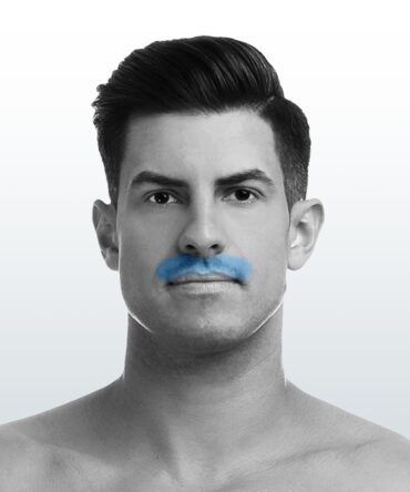 Depilación Bigote (XS) - Santiago