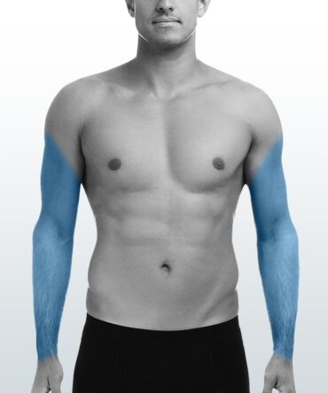 Depilación Brazo Completo (L) - Santiago