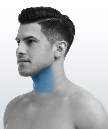 Depilación Cuello Anterior (S) - Santiago