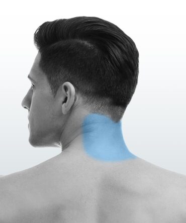 Depilación Cuello Posterior (S) - Santiago