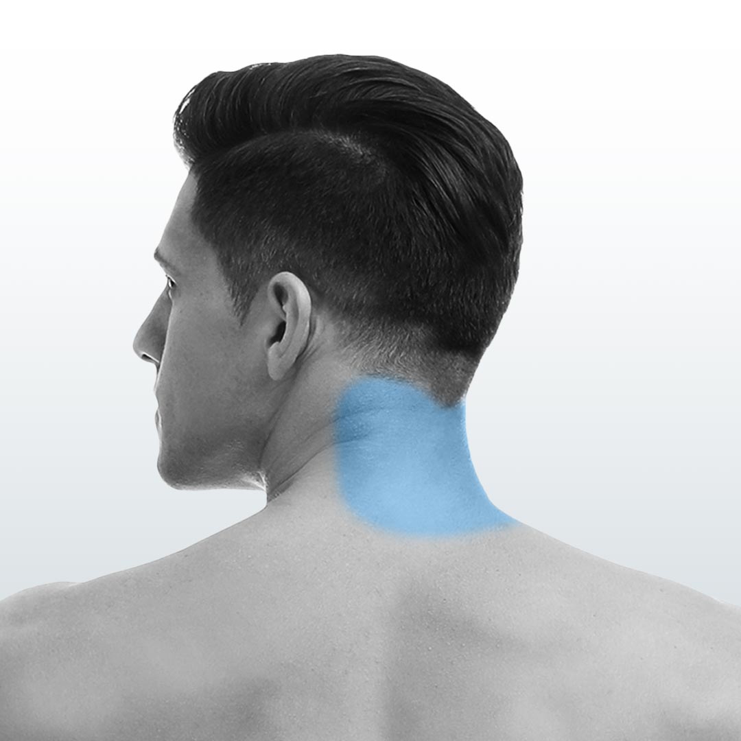 Depilación Cuello Posterior (S) - Santiago