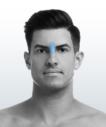 Depilación Entrecejo (XS) - Santiago