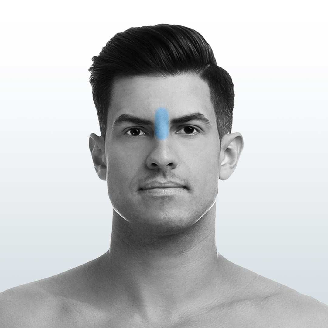 Depilación Entrecejo (XS) - Santiago