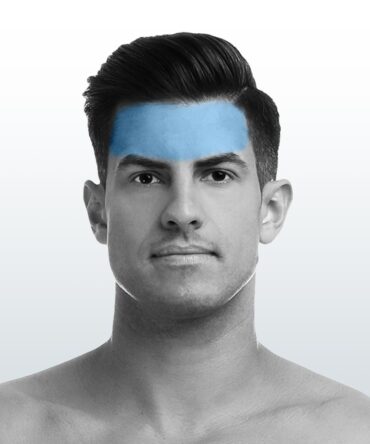 Depilación Frente (S) - Santiago