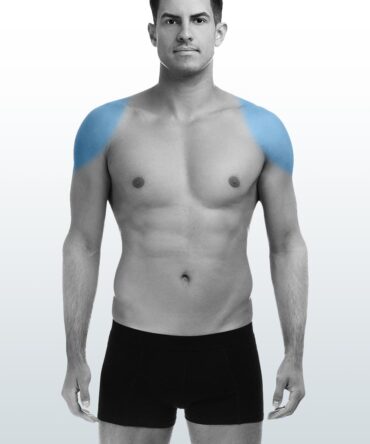 Depilación Hombros (S) - Santiago