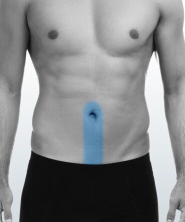 Depilación Línea Alba (S) - Santiago