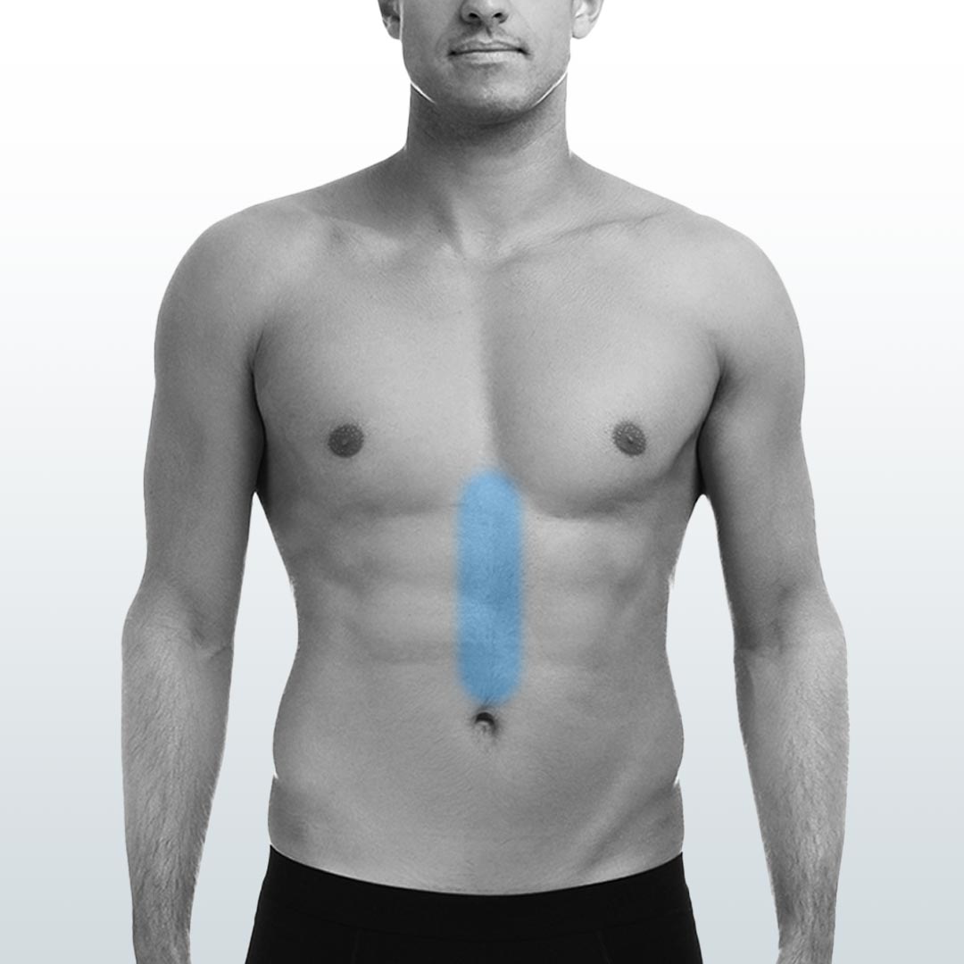 Depilación Línea Media (S) - Santiago