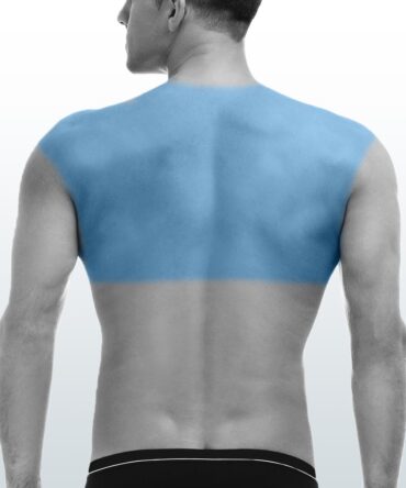 Depilación Espalda Superior (M) - Santiago