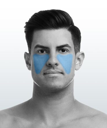 Depilación Mejillas (XS) - Santiago