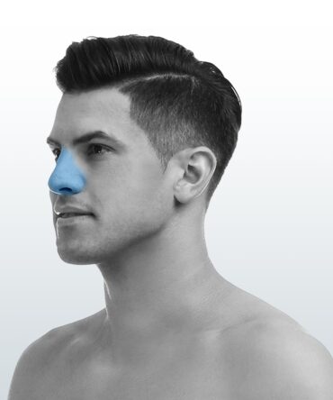 Depilación Nariz (XS) - Santiago