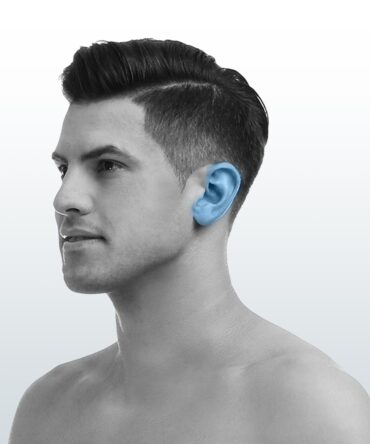 Depilación Orejas (XS) - Santiago