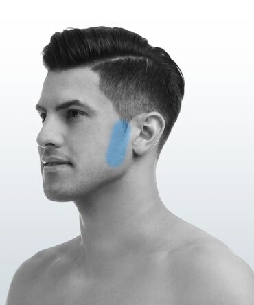 Depilación Patillas (XS) - Santiago