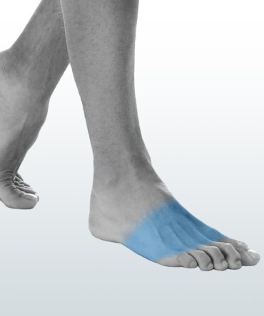 Depilación Empeines (XS) - Santiago