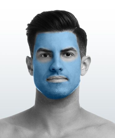 Depilación Rostro Completo (L) - Santiago