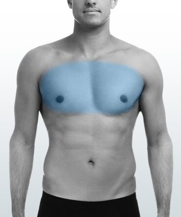 Depilación Pecho (M) - Santiago