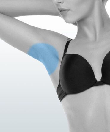 Depilación Axilas (S) - Santiago