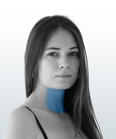 Depilación Cuello Anterior (S) - Santiago