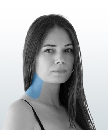 Depilación Cuello Posterior (S) - Santiago