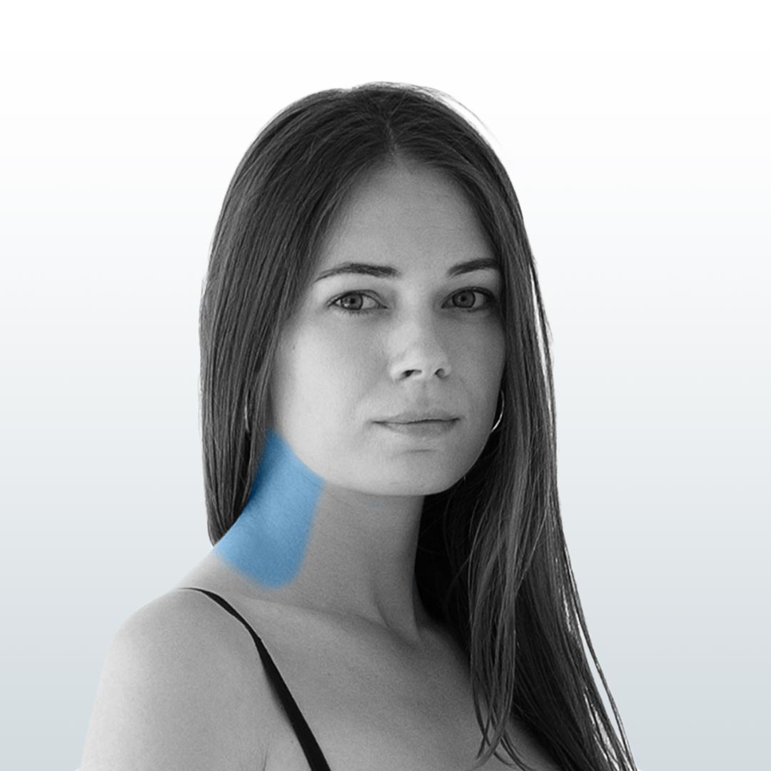 Depilación Cuello Posterior (S) - Santiago