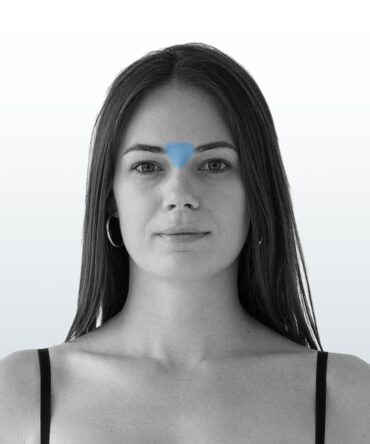 Depilación Entrecejo (XS) - Santiago