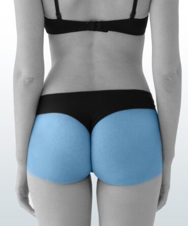 Depilación Glúteos (M) - Santiago