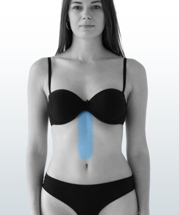 Depilación Línea Media (S) - Santiago