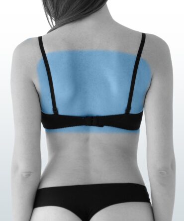 Depilación Espalda Superior (M) - Santiago