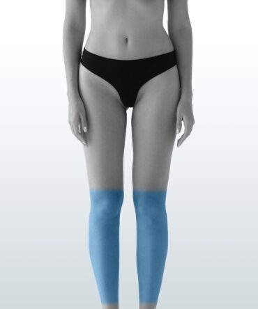 Depilación Media Pierna (L) - Santiago