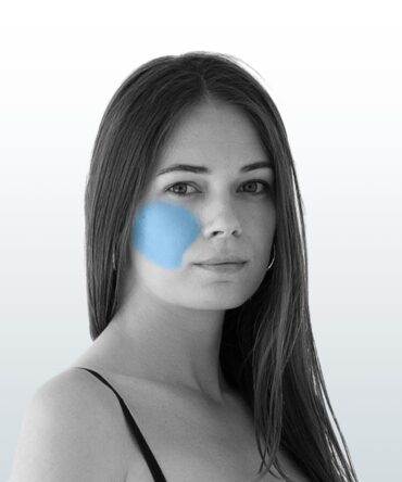 Depilación Mejillas (XS) - Santiago