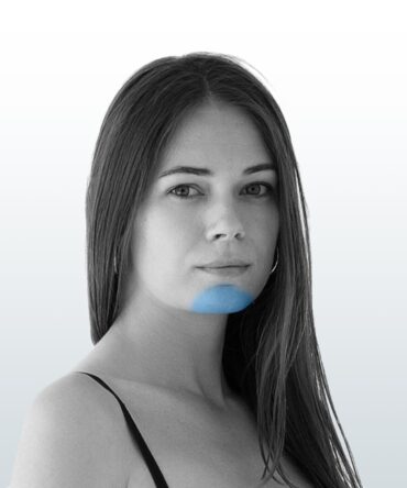 Depilación Mentón (XS) - Santiago