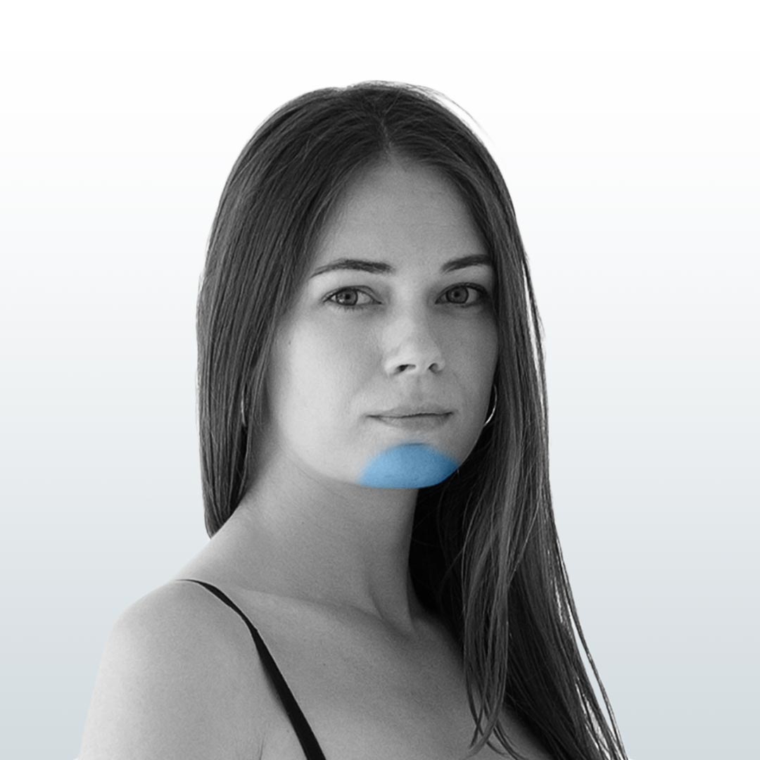 Depilación Mentón (XS) - Santiago