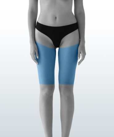 Depilación Muslos (L) - Santiago