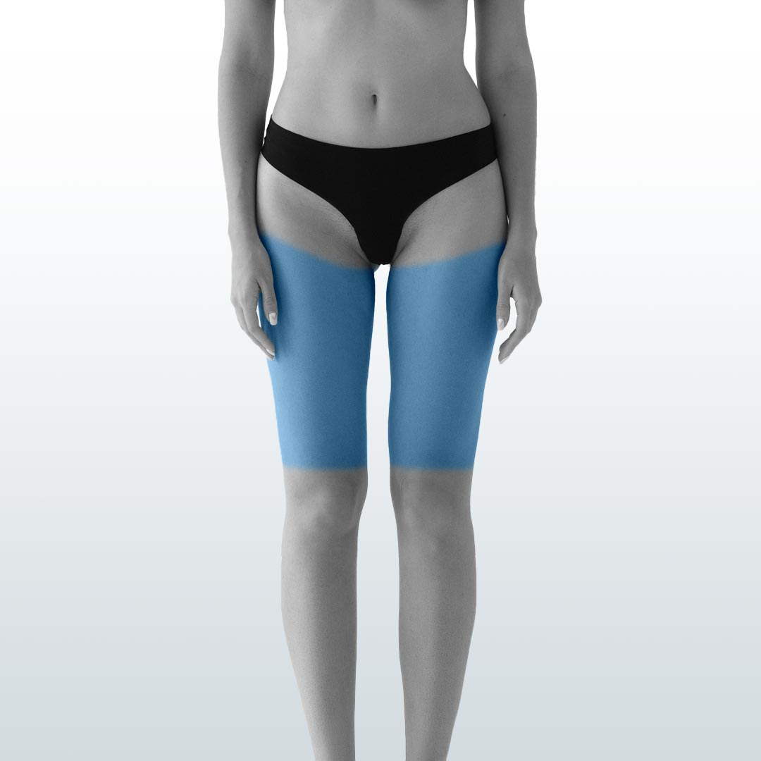 Depilación Muslos (L) - Santiago