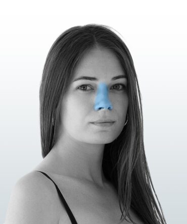 Depilación Nariz (XS) - Santiago