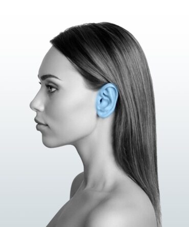 Depilación Orejas (XS) - Santiago