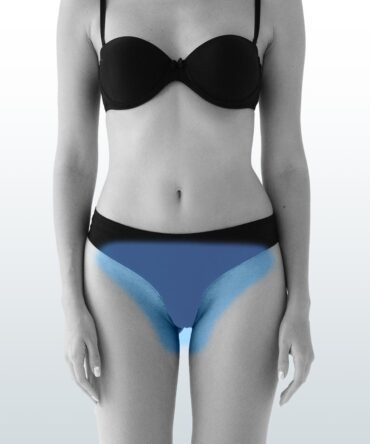 Depilación Rebaje Total (L) - Santiago