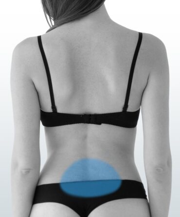 Depilación Sacrocoxis (S) - Santiago